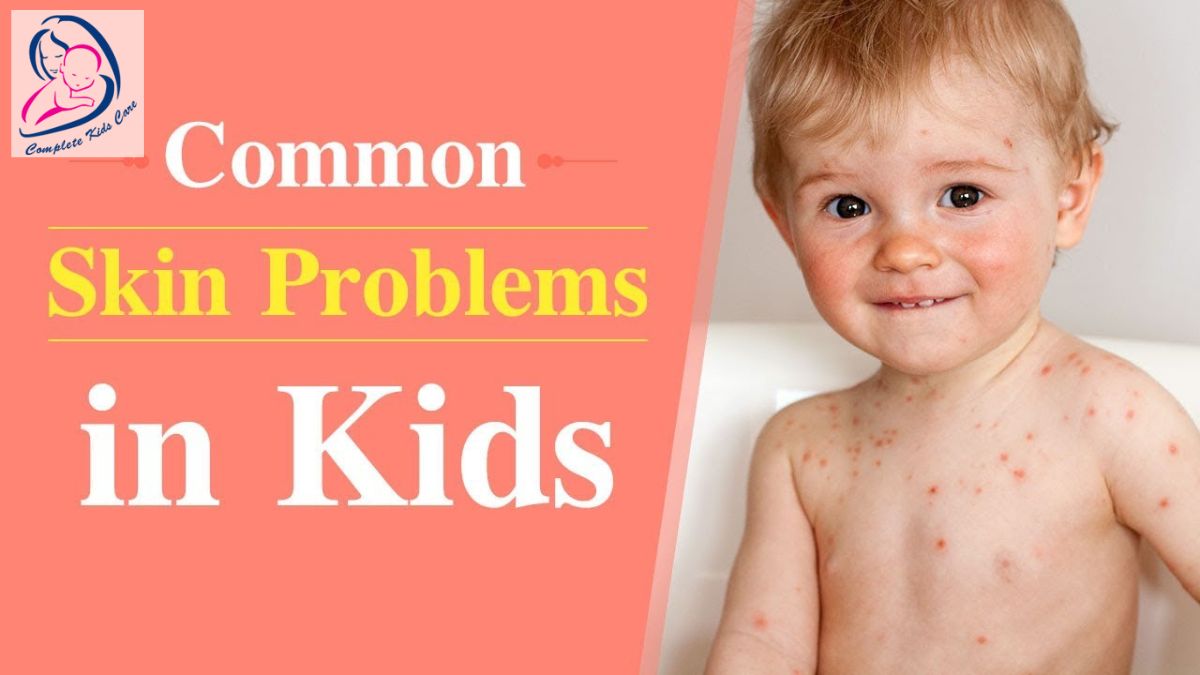 Skin Diseases In Childrens-Dr Priyanka Jain-Bachpan Kids Care Clinic (1)