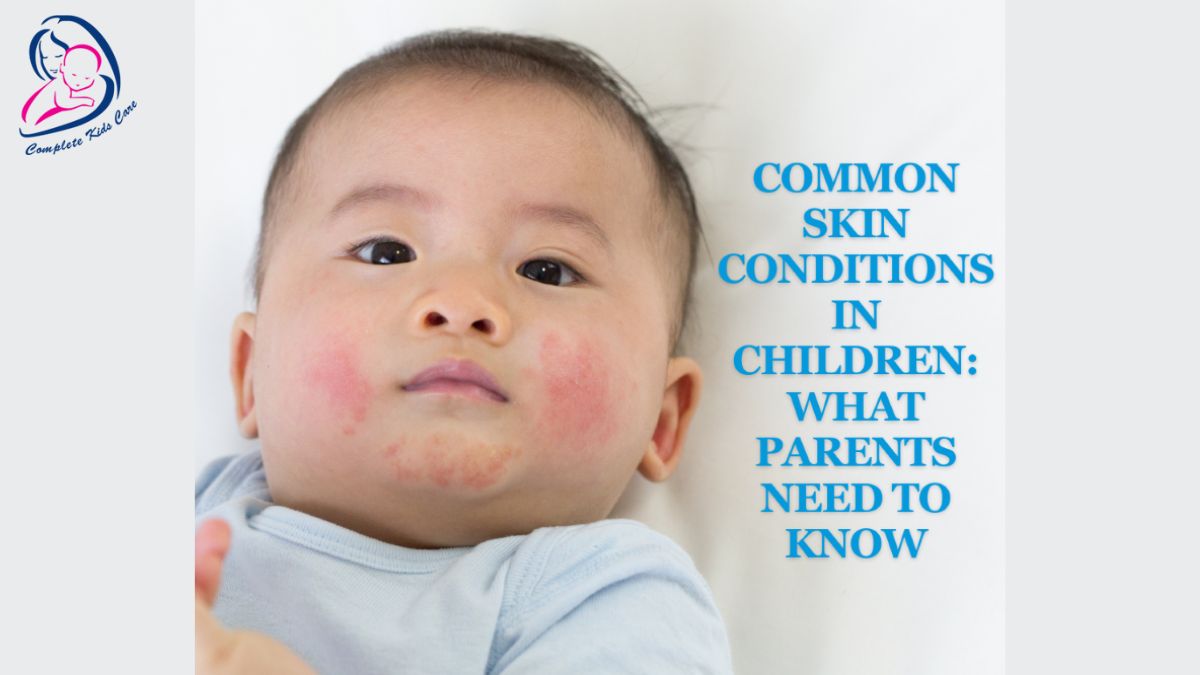 Skin Diseases In Childrens-Dr Priyanka Jain-Bachpan Kids Care Clinic (2)