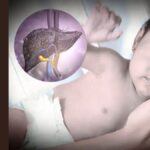 Hepatitis in Kids - Dr Priyanka Jain - Child Specialist Doctor Near Me