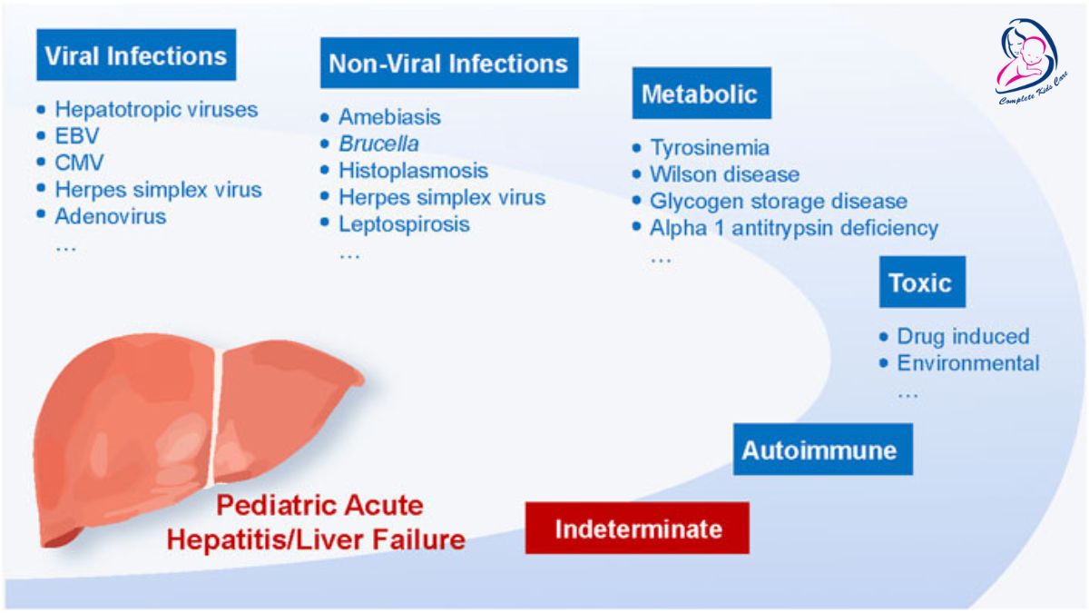 Hepatitis in kids by Dr Priyanka Jain - Child Specialist Doctor Near Me