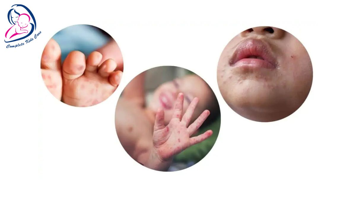 Childhood Illness by dr Priyanka Jain, Child Specialist